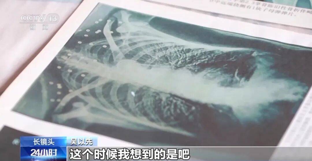 “老先生<strong></p>
<p>宏鑫機(jī)械設(shè)備有限公司
</strong>，您把項(xiàng)鏈取下來再做CT”“你看是不是彈片”:宏鑫機(jī)械設(shè)備有限公司
